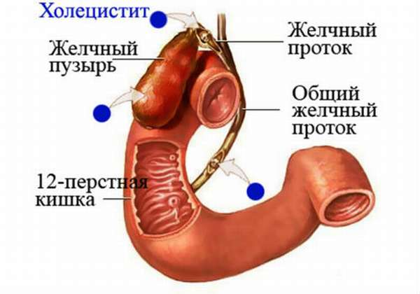 особенности заболевания